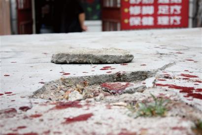 按摩店2男因對視一眼1男抽刀追砍 血人當街狂奔