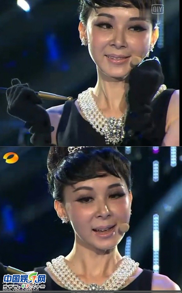 絕色美女難逃衰老 保養過度面容僵硬無表情