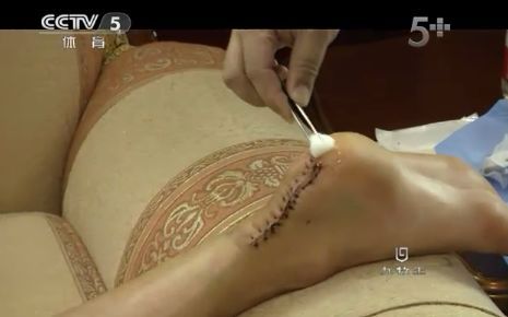 劉翔自稱經(jīng)得起歷史考驗(yàn) 稱腳傷時(shí)感覺被抽了一鞭子