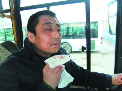 司機(jī)奉勸怪異客換來(lái)八記封眼錘